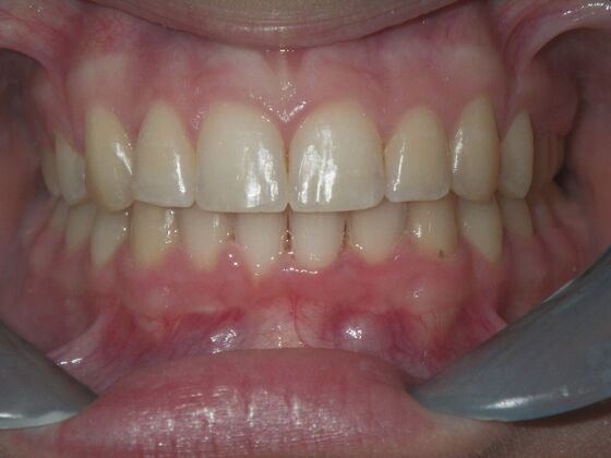 Orthodontics: Case 7 - After