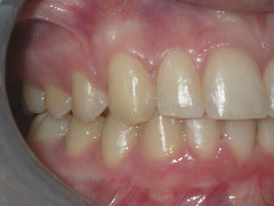 Orthodontics: Case 7 - After