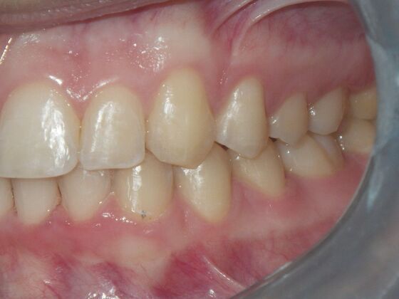 Orthodontics: Case 7 - After