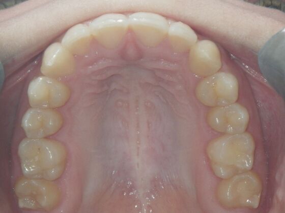 Orthodontics: Case 7 - After
