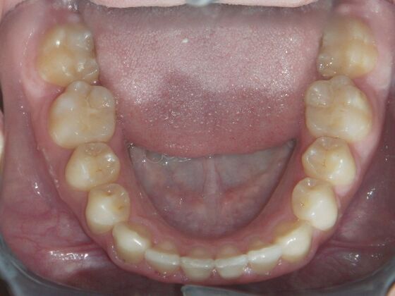 Orthodontics: Case 7 - After