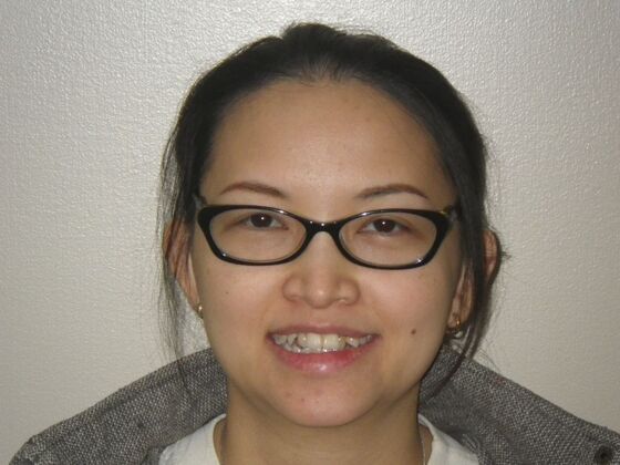 Orthodontics: Case 9 - Before