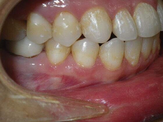 Orthodontics: Case 9 - After