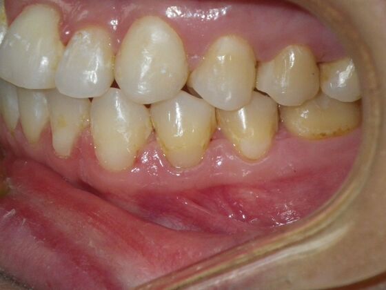 Orthodontics: Case 9 - After
