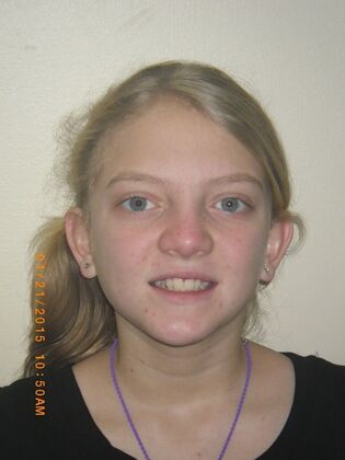 Orthodontics: Case 10 - Before
