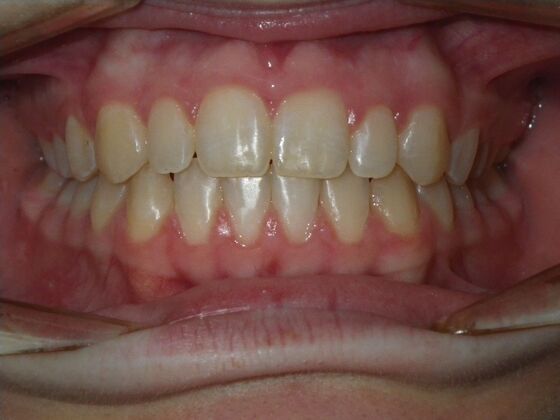 Orthodontics: Case 10 - After