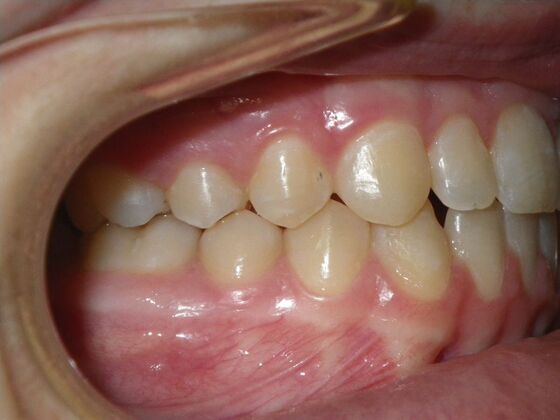 Orthodontics: Case 10 - After