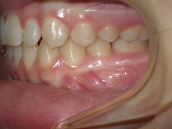 Orthodontics: Case 10 - After