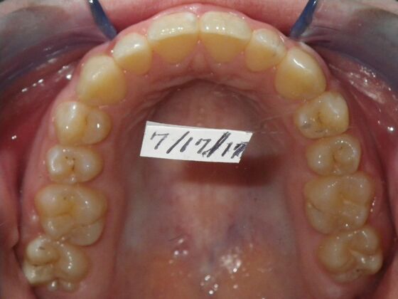 Orthodontics: Case 10 - After