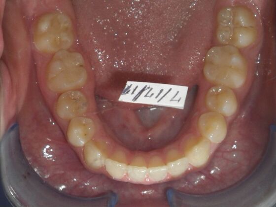 Orthodontics: Case 10 - After