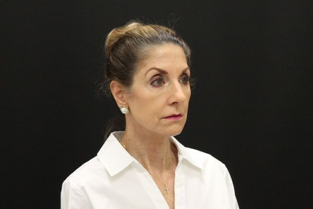 Face & Neck Lifts: Case 1 - After