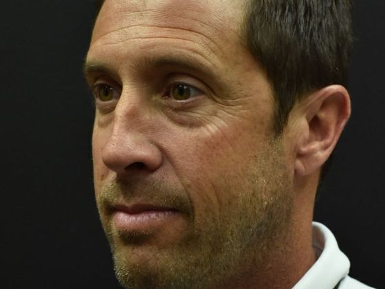 Eyelid Surgery: Case 1 - Before