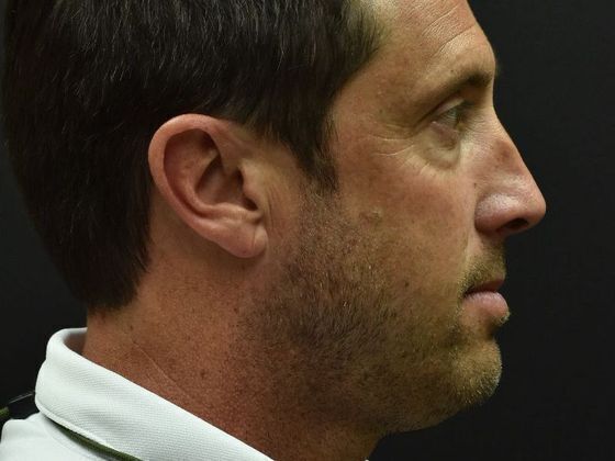 Eyelid Surgery: Case 1 - After