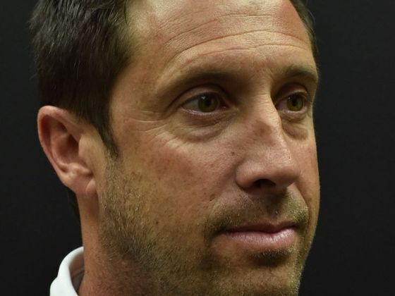 Eyelid Surgery: Case 1 - Before