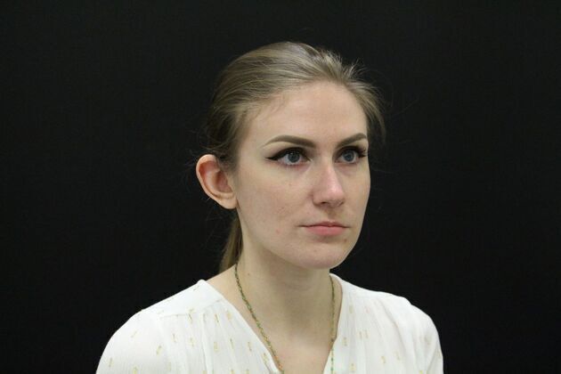 Otoplasty: Case 1 - Before