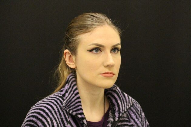 Otoplasty: Case 1 - After