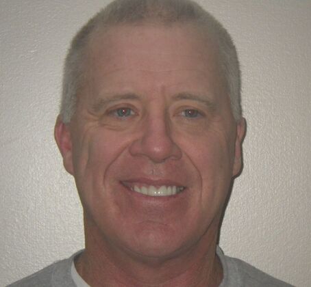 Cosmetic Changes with Veneers and Crown and Bridge: Case 5 - After