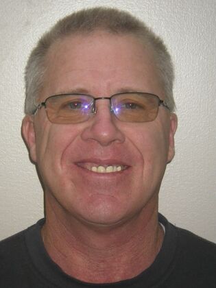 Cosmetic Changes with Veneers and Crown and Bridge: Case 5 - Before