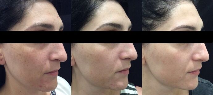 Skin Treatments Case 4