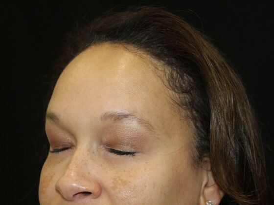 Skin Treatments: Case 6 - Before