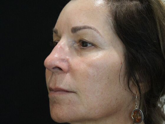 Skin Treatments: Case 7 - Before