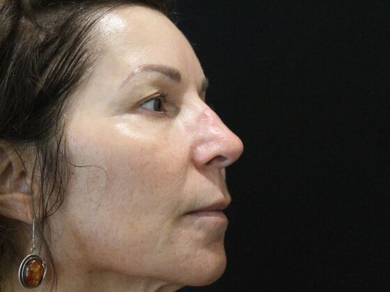 Skin Treatments: Case 7 - Before