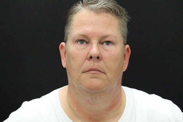 Face & Neck Lifts Case 26 - Before