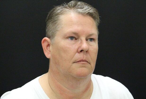 Face & Neck Lifts: Case 26 - Before