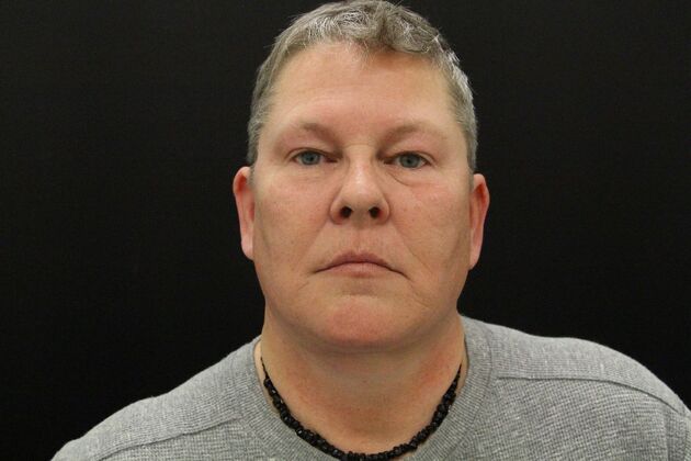 Face & Neck Lifts Case 26 - After