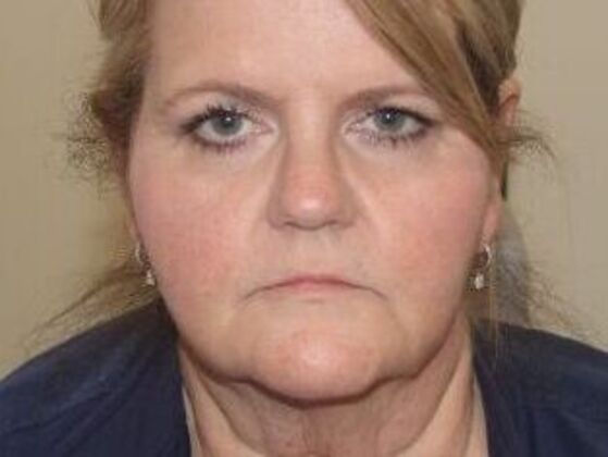 Injectables Case 62 - Before