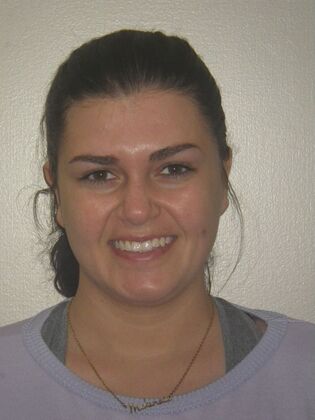 Invisalign: Case 18 - Before