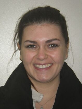 Invisalign: Case 18 - After