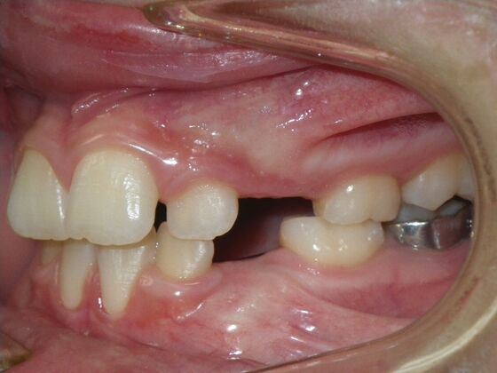 Orthodontics: Case 43 - Before