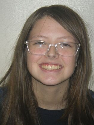 Orthodontics: Case 43 - After