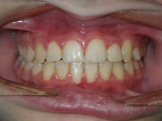 Orthodontics: Case 43 - After