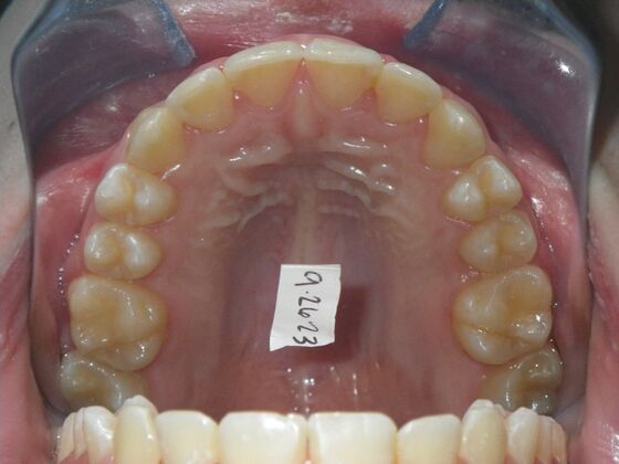 Orthodontics: Case 43 - After