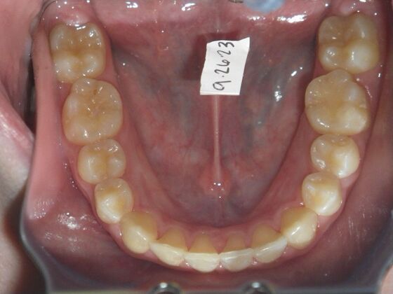 Orthodontics: Case 43 - After
