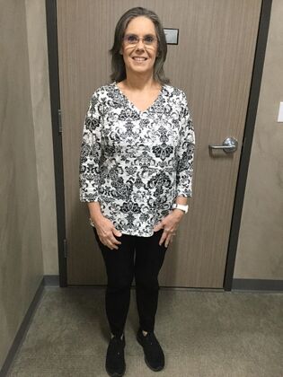 Gastric Sleeve: Case 5 - After