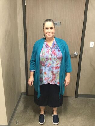 Gastric Sleeve: Case 5 - Before