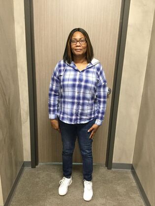 Gastric Sleeve: Case 6 - After