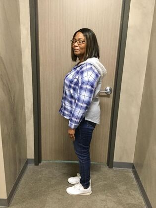 Gastric Sleeve: Case 6 - After