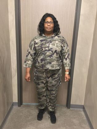 Gastric Sleeve: Case 6 - Before