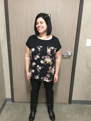 Gastric Sleeve: Case 7 - After