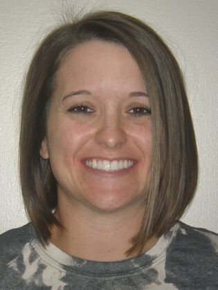 Invisalign: Case 11 - After