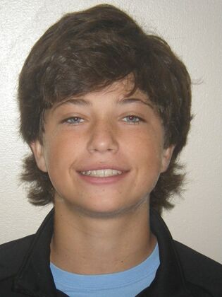 Orthodontics: Case 44 - After