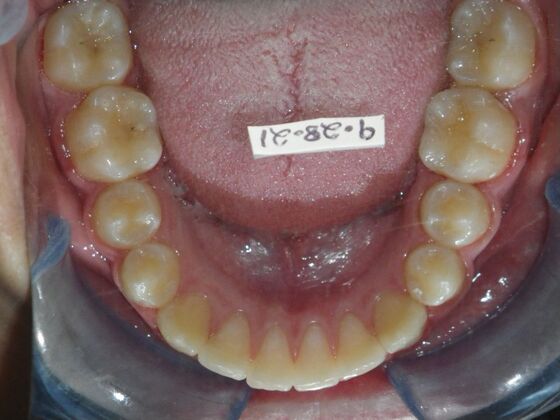 Orthodontics: Case 44 - After