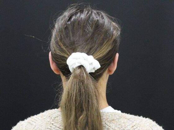 Otoplasty: Case 2 - After