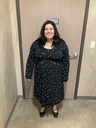 Gastric Sleeve: Case 7 - Before