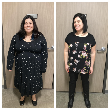 Gastric Sleeve Cases