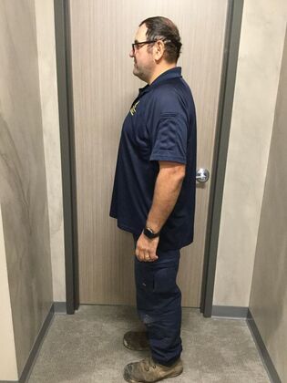 Gastric Sleeve: Case 9 - After